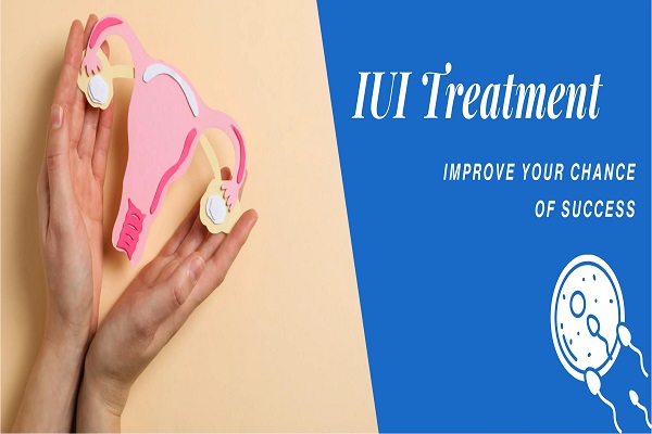 Best Iui Doctor in Delhi