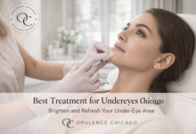 Best treatment for undereyes Chicago