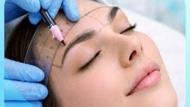 Eyebrow Transplant Chicago