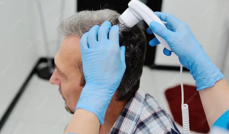 Exosome Treatment for Hair Loss​
