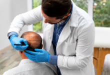 Hair Transplant Chicago