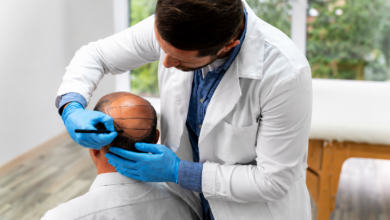 Hair Transplant Chicago