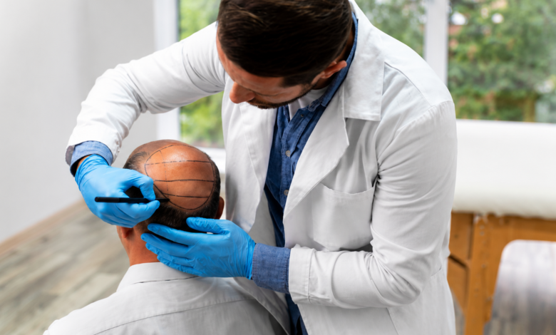 Hair Transplant Chicago