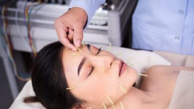 Thread Lift Treatment in Kolkata