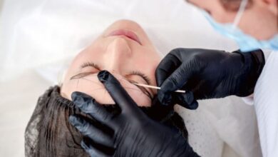 Eyebrow Transplant Chicago