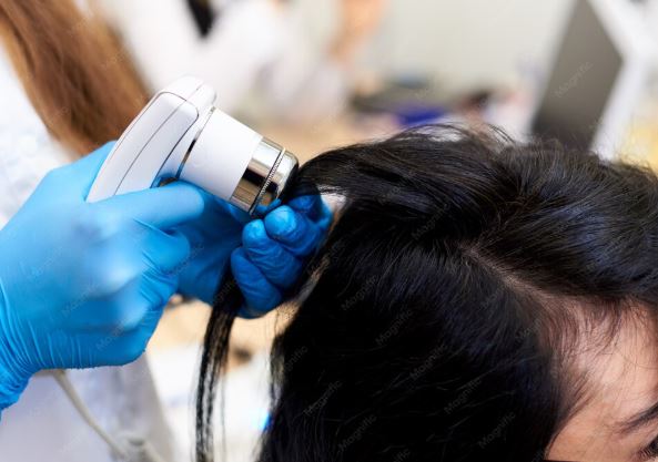 Exosomes Hair Treatment